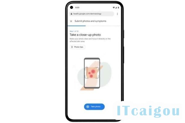 谷歌推出新AI工具 可识别常见皮肤状况